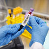 Etiquetas ultra delgadas de poliéster para laboratorios con parte superior para viales, resistentes a sustancias químicas - Impresoras BMP61 M611 1